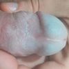 Přetahování předkožky po frenuloplastice
