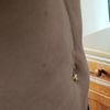 Argoliposukce - plazmová liposukce