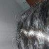 Prosvítající kůže ve vlasech padání vlasů lupy