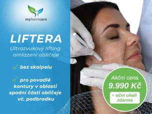 Ultrazvukový lifting omlazení obličeje LIFTERA + oční okolí zdarma