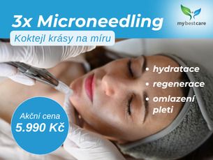 3x microneedling: koktejl krásy na míru - AKČNÍ CENA 5.990 Kč