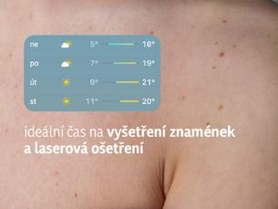 Sbohem, znaménka a jiné nežádoucí „ozdoby“! 👋
