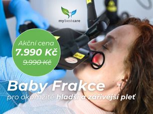 BABY FRAKCE | jarní reset Vaší pleti za 7.990 Kč