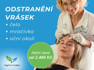 Odstranění vrásek neuromodluční látkou
