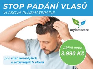 Plazmaterapie pro Vaše vlasy - AKČNÍ CENA 3.990 Kč