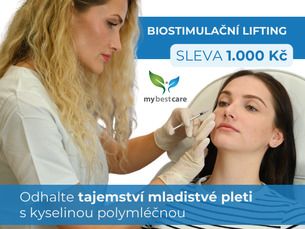 BIOSTIMULAČNÍ LIFTING kys. polymléčnou - SLEVA 1.000 Kč