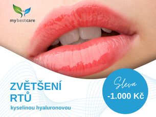 KRÁSNÉ RTY - výplň rtů s kys. hyaluronovou SLEVA 1.000 Kč