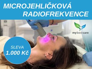 VIVACE Mikrojehličková radiofrekvence - SLEVA 1.000 Kč