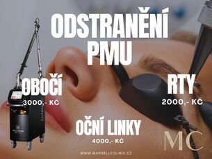 Odstranění černého i barevného tetování