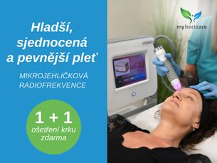 MIKROJEHLIČKOVÁ RADIOFREKVENCE Vivace 1+1 ošetření krku zdarma