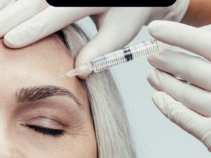 Výplně a botox - celkový refresh obličeje