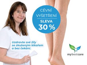 Vstupní cévní vyšetření nyní se SLEVOU 30 %