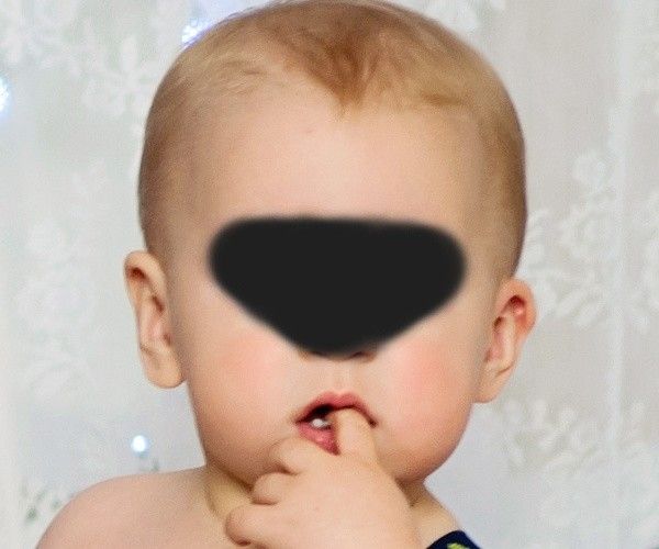 Každé ucho jiné