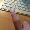 Zvětšený kloub po zlomenině prstu - 12988