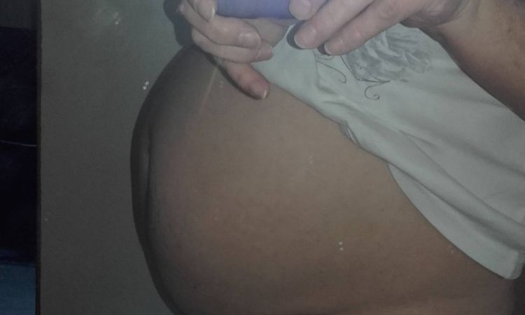 Břicho jako míč - vyboulené s převisem - 13384