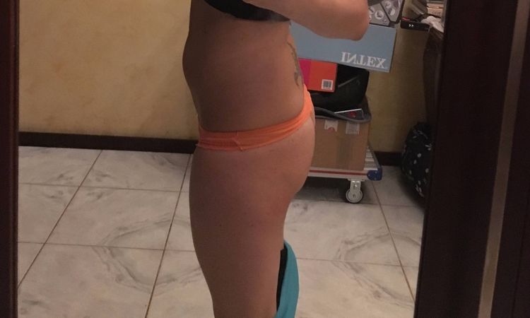 Liposukce: Klasická nebo SlimLipo ? - 13397