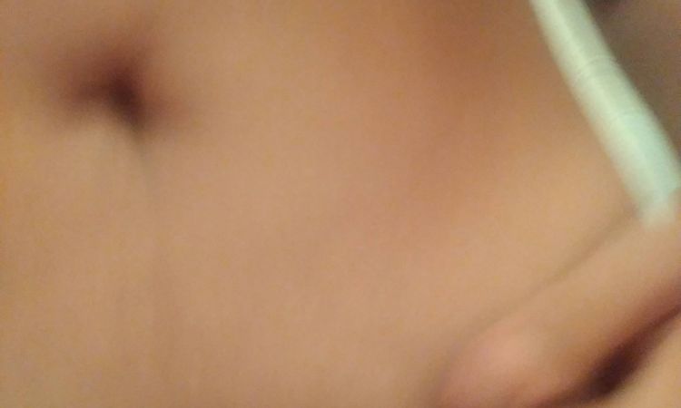 Miniabdominoplastika - 13400