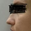 Zmenšení nosu, silná mastná pokožka - 13529