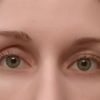 Operace jednoho očního víčka - ptoza - 13602