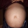 Odstranění přebytečnéhu tuku na břiše pomocí exillis - jsem vhodný kandidát?