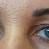 Úprava očních víček - doporučení ?
