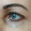 Úprava očních víček - doporučení ?