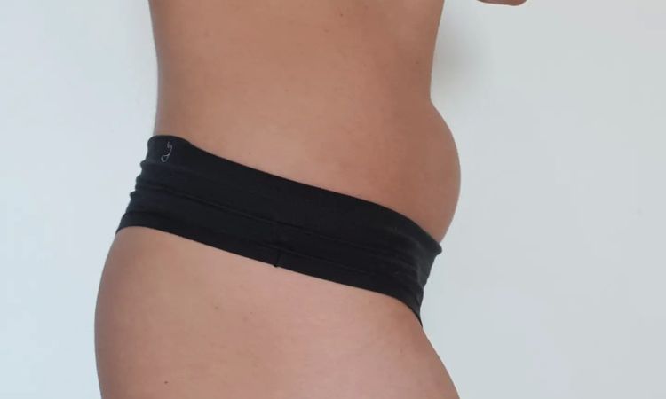Jaká alternativa liposukce - břicho (foto) - 14178