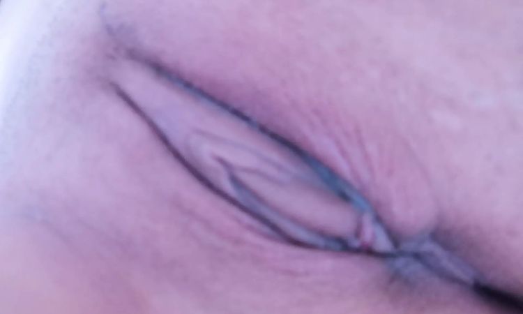 Labioplastika krvácení, menstruace a otok - 14278