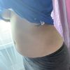 Břicho, které nejde zhubnout - liposukce