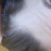 Řídnutí vlasů: mezoterapie, plazmateripe, PRP nebo vodičky? - 16097