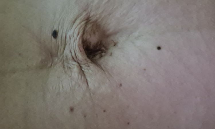 Flexr po těhotenství a nebo počkat až po dalším? - 16740