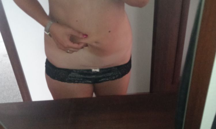 Neprovedená liposukce? - 56246