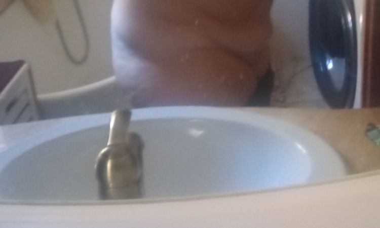 Abdominoplastika břicha - 58017