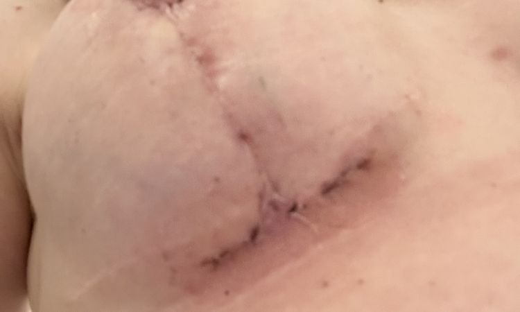 Je možná oprava s uspokojivim výsledkem? - 61352