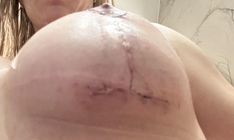 Je možná oprava s uspokojivim výsledkem? - 61353