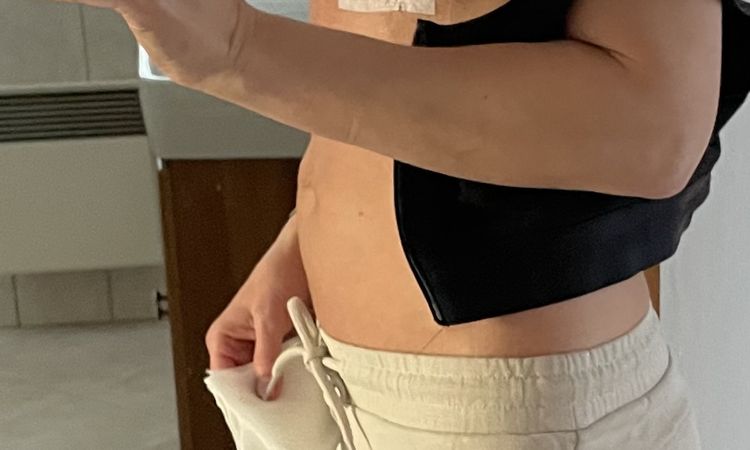 Až se vše zahojí budou prsa přirozená ? - 62328