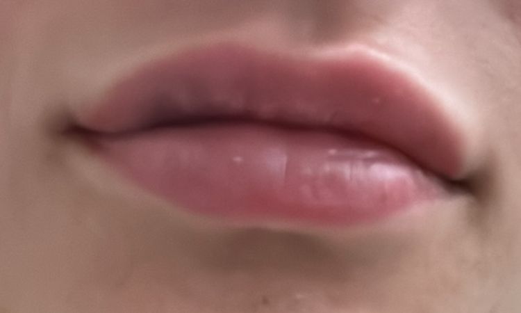 O hodně zvětšené rty než před tím - 79912