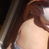Abdominoplastika se sešitím břišních svalů + pupeční kýla