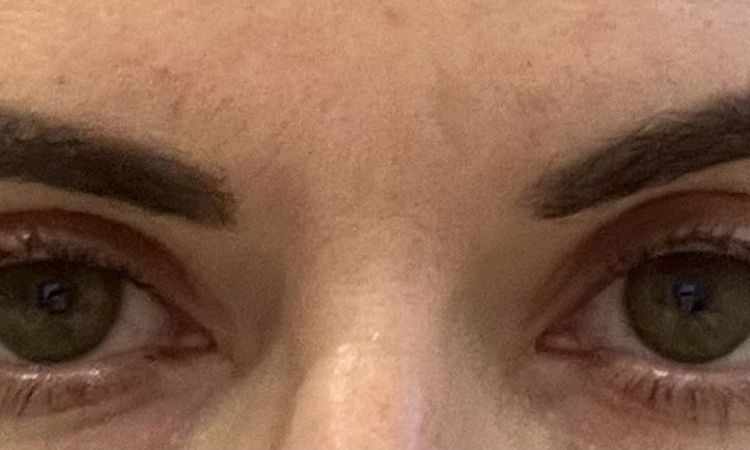 Posouzení nedovření oční štěrbiny - 82776