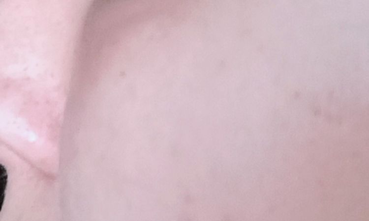 Kyselina hyaluronova - 83045