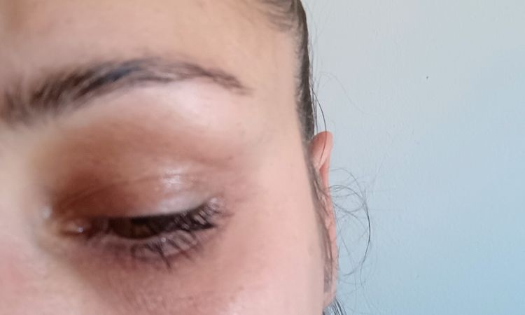 Kyselina hyaluronova - 83046