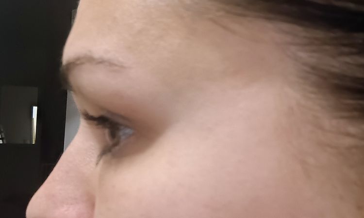 Kyselina hyaluronova - 83047