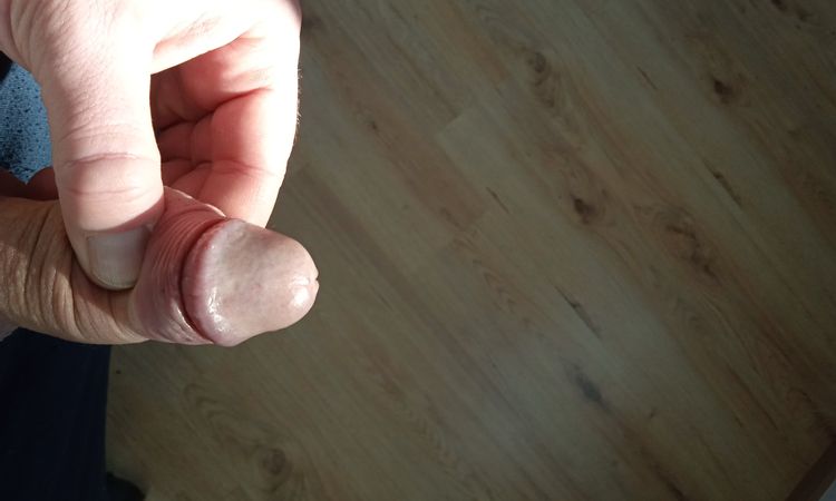 Žádná uzdička penisu - 83485