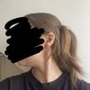 Má pro mě smysl lipolýza podbradku, nebo je nutno problém řešit jinak?