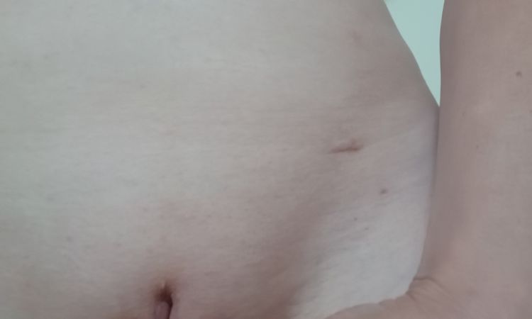 Prosím hľadám lekára ktorý by vedel estetický upraviť intímne partie - 84640