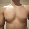 Pseudogynekonastie gyno
