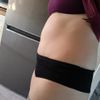 Abdominoplastika a znovu kýla