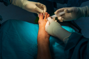 Jak se provádí operace Hallux valgus?