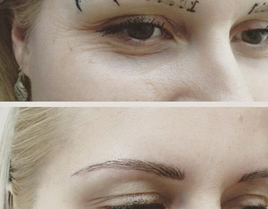 Mikropigmentace obočí