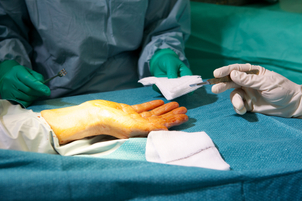 Jak se provádí chirurgie ruky?